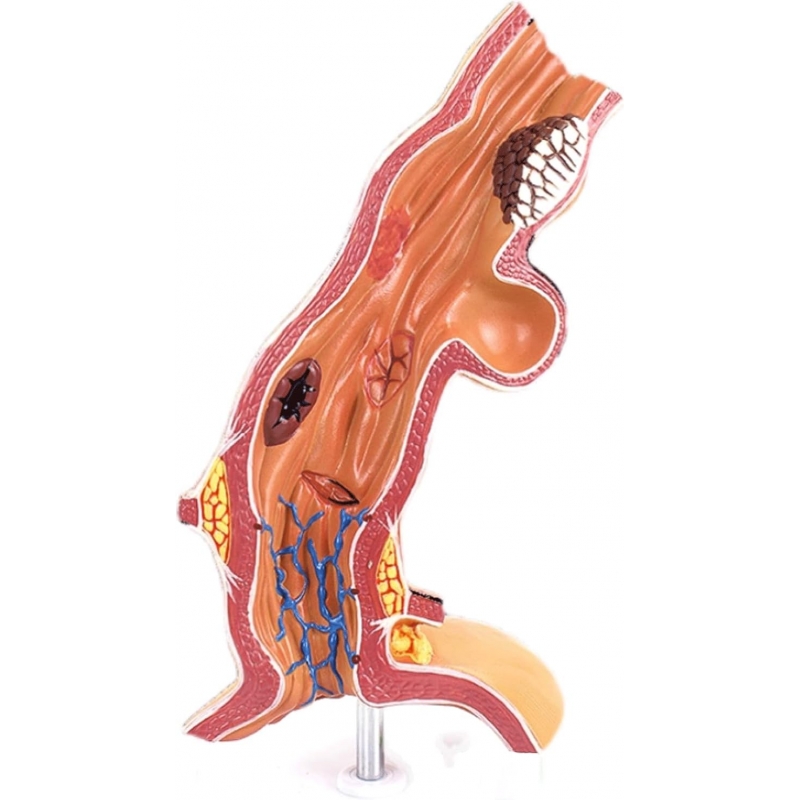 Esophagus Model - Myaskro
