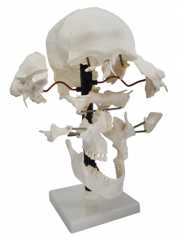 Exploded Human Skull Model - MYASKRO