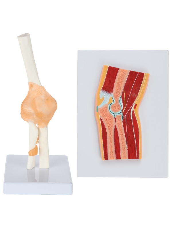 Functional Elbow Joint & Cross-Section Anatomy Model Bundle – Myaskro