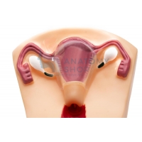 IUD Insertion Model for Teaching & Demonstration – Myaskro®
