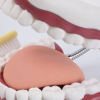 Giant Dental Teeth Model With Tongue And Tooth Brush 