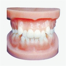 Orthodontic Model by Myaskro