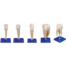 Lower Incisor, Canine, Molar With 1 Root & First Upper Molar With 3 Roots Model