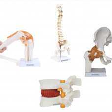 Human Joints Anatomical Models Set Of 4 - Knee Joint Model, Spine Model, Hip Joint Model And Lumbar Spine Herniation Prolapse Model
