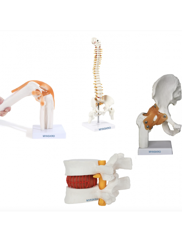 Human Joints Anatomical Models Set Of 4 - Knee Joint Model, Spine Model, Hip Joint Model And Lumbar Spine Herniation Prolapse Model