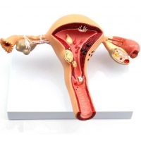 Female Reproductive System Anatomy & Pathology Bundle - Myaskro