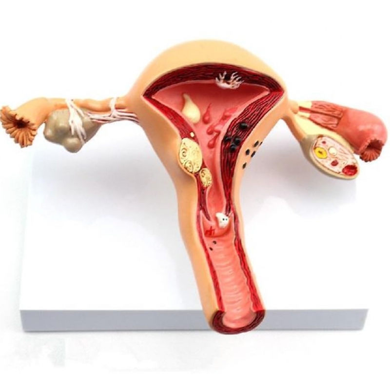 Uterus Ovary Anatomy Model With Extremely Precise Anatomical Details And Structures