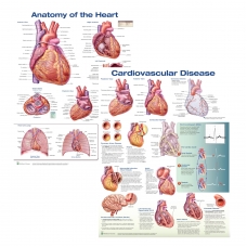 Anatomy of the Heart & Cardiovascular Disease Chart Bundle (52 × 70 cm, Set of 2) - Myaskro
