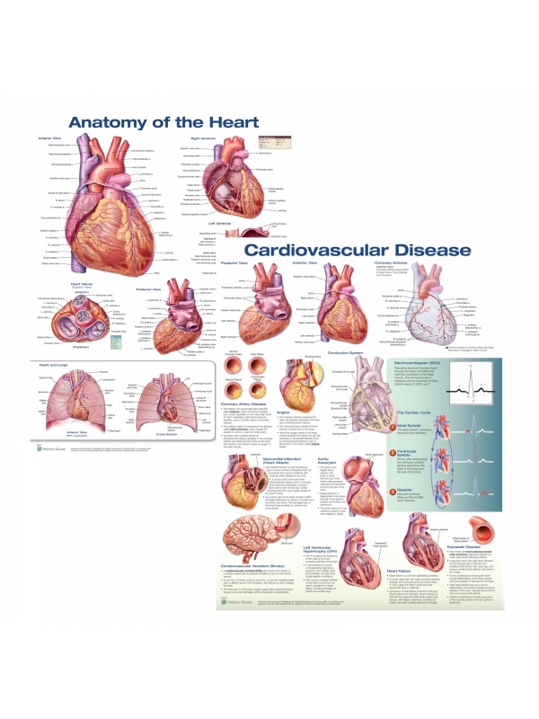 Anatomy of the Heart & Cardiovascular Disease Chart Bundle (52 × 70 cm, Set of 2) - Myaskro