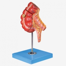Myaskro - Appendix And Caecum Anatomical Model