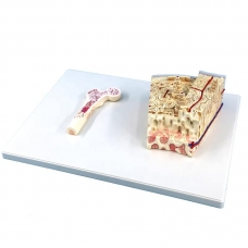 Bone Structure Model – Enlarged, Multilayer Section with Osteon and Vascular Detailing - Myaskro