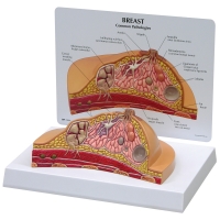 Breast Anatomy & Pathology Bundle - Myaskro