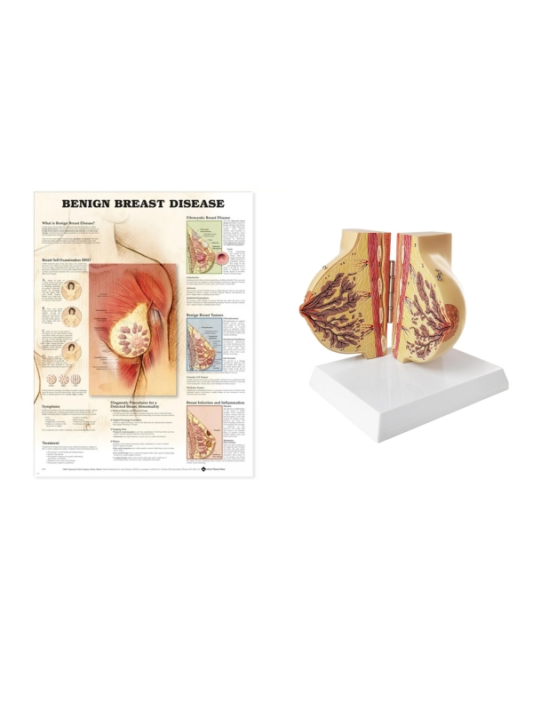 Breast Anatomy Model with Breast Disease Chart Bundle - Myaskro
