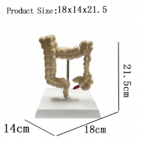 Myaskro - Colon Pathological Model Showing Various Pathologies