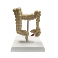 Myaskro - Colon Pathological Model Showing Various Pathologies