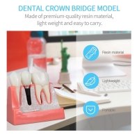 Dental Implant Model - Myaskro