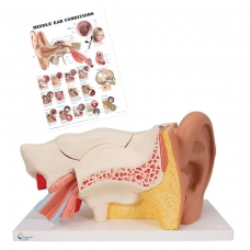 Ear Model with Ear Chart | Patient Education Bundle - Myaskro