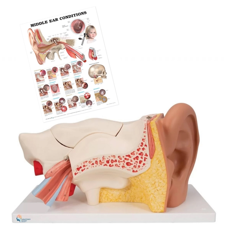 Ear Model with Ear Chart | Patient Education Bundle - Myaskro