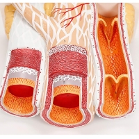 Enlarged Artery & Vein Model — MYASKRO