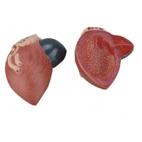 Urinary Bladder Expansion Model - MYASKRO