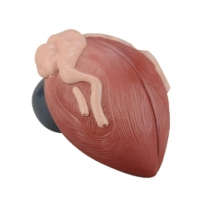 Urinary Bladder Expansion Model - MYASKRO