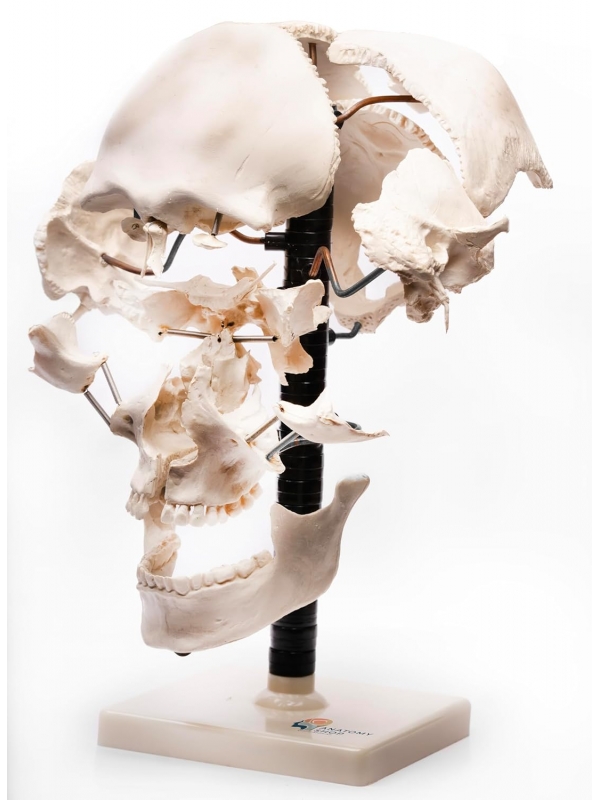 Exploded Human Skull Model - MYASKRO