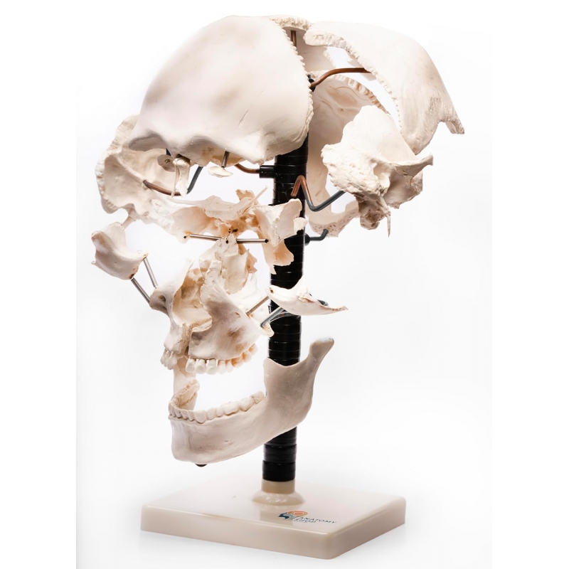 Exploded Human Skull Model - MYASKRO