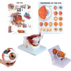 Eye Anatomy & Pathology Bundle with Cataract Model — MYASKRO