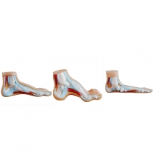 Arched Foot, Normal Foot & Flat Foot - Set of 3 Foot Anatomical Models by Myaskro