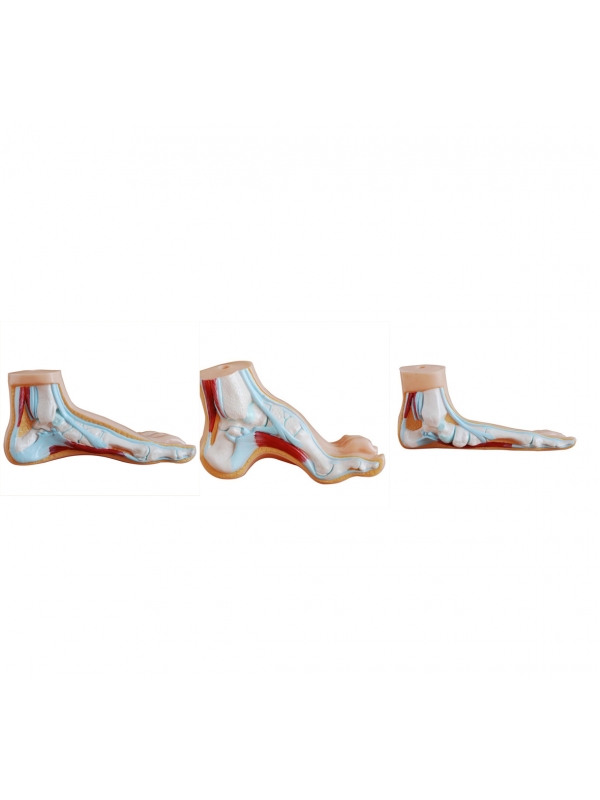 Arched Foot, Normal Foot & Flat Foot - Set of 3 Foot Anatomical Models by Myaskro