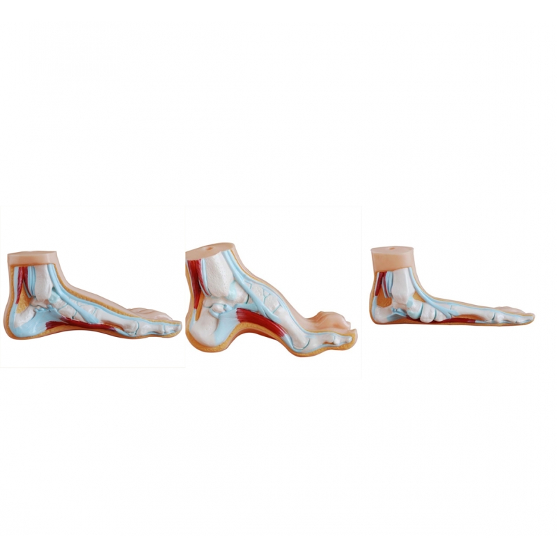 Arched Foot, Normal Foot & Flat Foot - Set of 3 Foot Anatomical Models by Myaskro