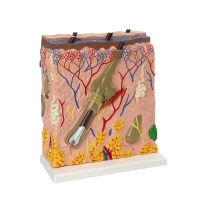 Skin Anatomy and Pathology Bundle (2 Skin Models + 2 Charts) - Myaskro