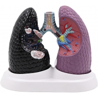 Lung Anatomy & Pathology Bundle - Myaskro
