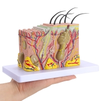 Skin Anatomy and Pathology Bundle (2 Skin Models + 2 Charts) - Myaskro