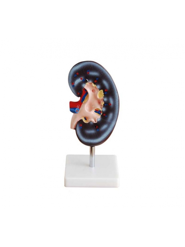 Kidney Model (Enlarged) – Myaskro