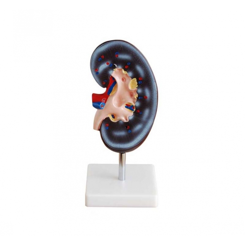 Kidney Model (Enlarged) – Myaskro