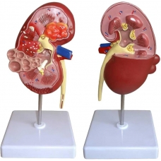 Human Kidney Model