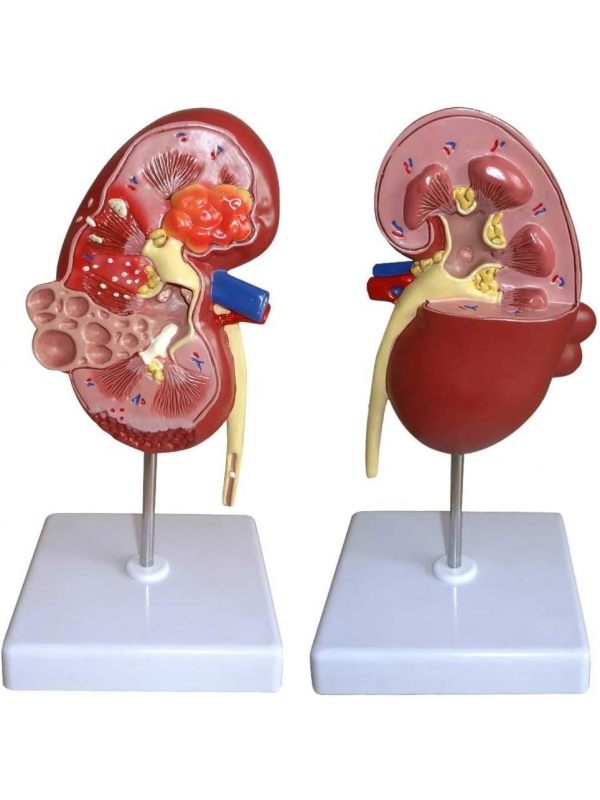 Human Kidney Model