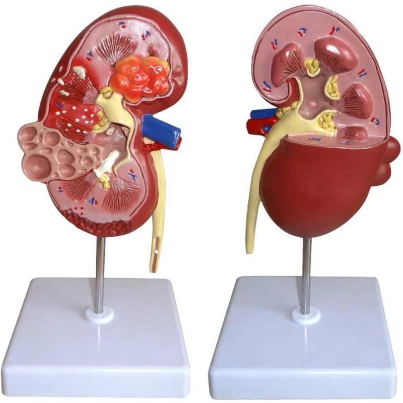 Human Kidney Model