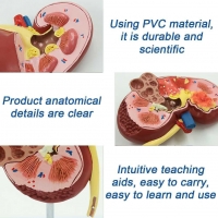 Human Kidney Model