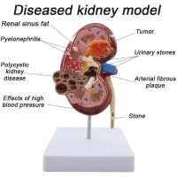 Human Kidney Model