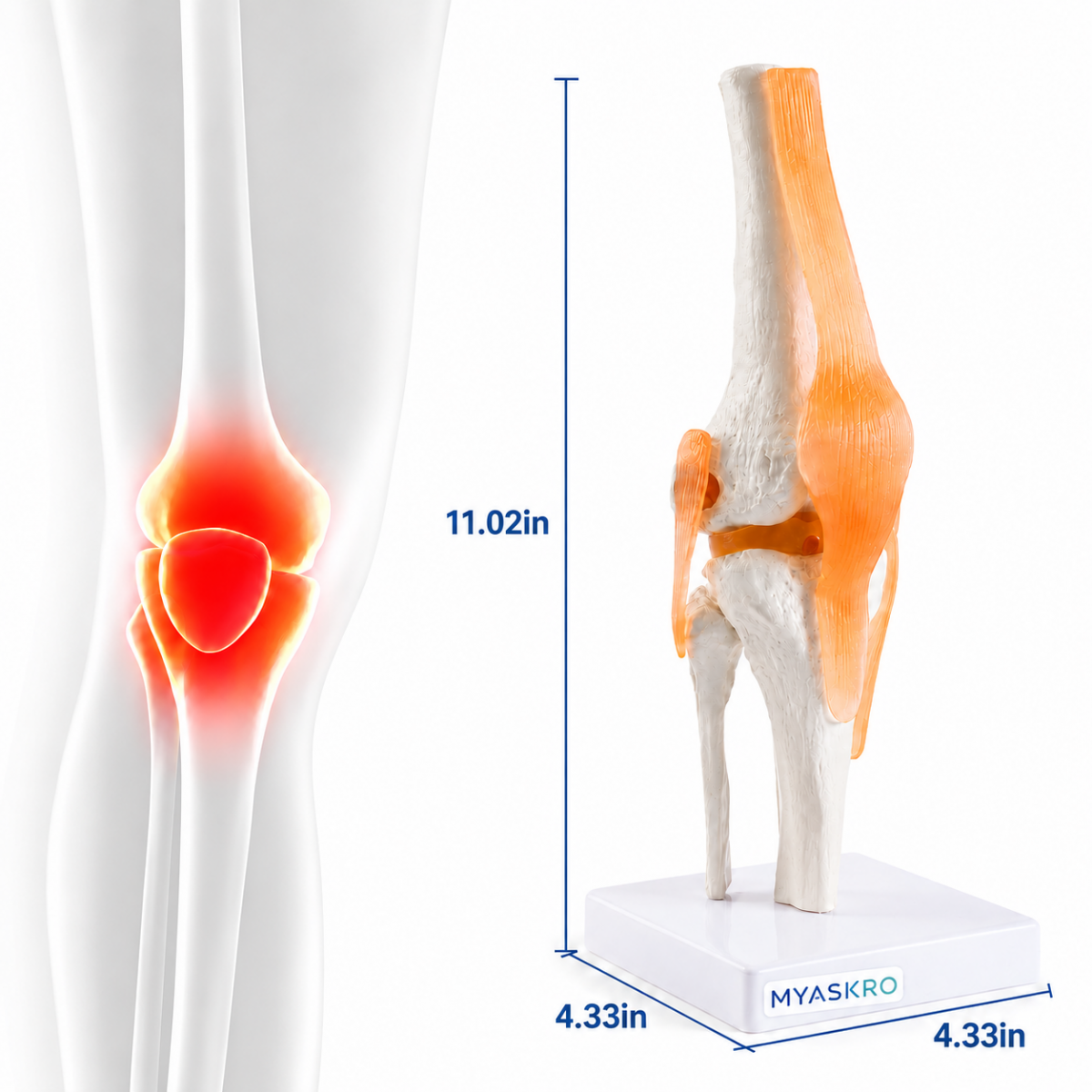 Knee Joint Model With Flexible Ligaments