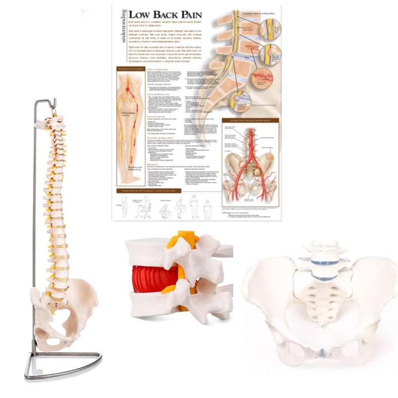 Lower Back Pain Models + Chart Bundle | 85cm Spine Model, Lumbar Herniated Disc Model & Pelvis with 2 vertebrae