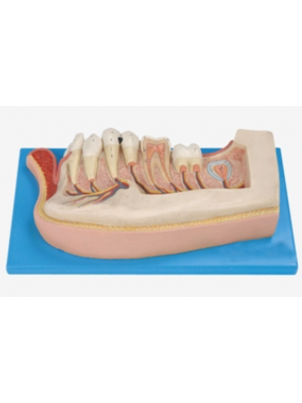  Lower Jaw Of 12-Year-Old Dental Model