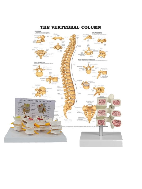 Osteoporosis Anatomical Models Bundle - Myaskro
