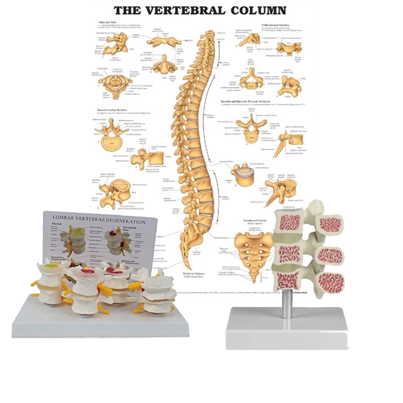 Osteoporosis Anatomical Models Bundle - Myaskro