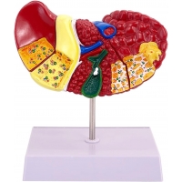 Liver Anatomy & Pathology Bundle - Myaskro