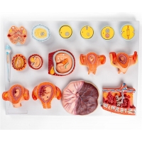 MYASKRO Pregnancy Anatomy Model Bundle