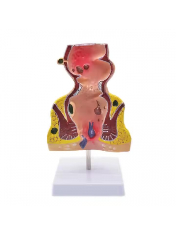 Rectum and Anal Canal Anatomical Model - Myaskro