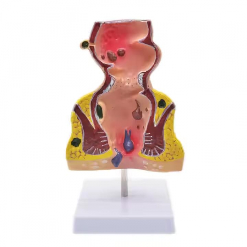 Rectum and Anal Canal Anatomical Model - Myaskro